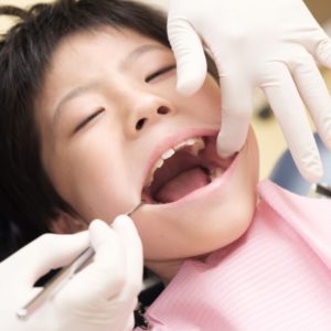 子どもの矯正治療、むし歯に注意