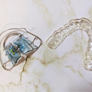 全て永久歯だと、小児矯正でも抜歯は必要なの？